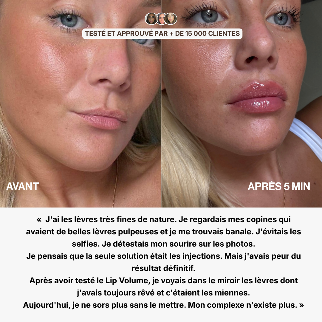 Lip Volume (Offre limitée)