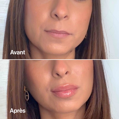 Lip Volume (Offre limitée)