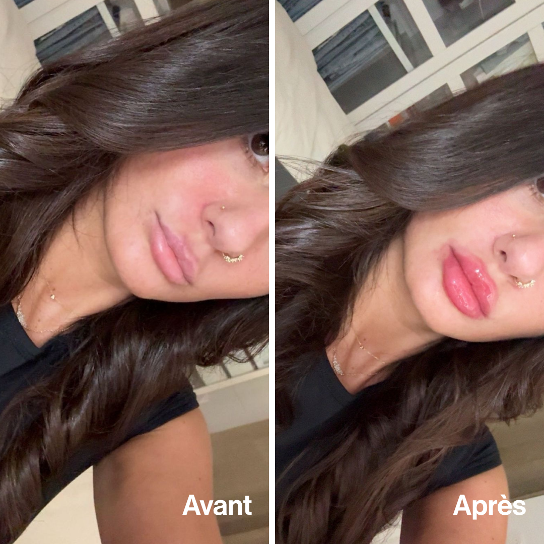Lip Volume (Offre limitée)