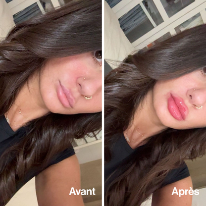 Lip Volume (Offre limitée)